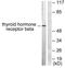 Thyroid Hormone Receptor Beta antibody, TA311778, Origene, Western Blot image 