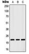 RAB35, Member RAS Oncogene Family antibody, LS-B13626, Lifespan Biosciences, Western Blot image 