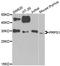 Phosphoribosyl Pyrophosphate Synthetase 1 antibody, A02704, Boster Biological Technology, Western Blot image 