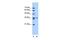 Solute Carrier Family 35 Member A3 antibody, GTX46820, GeneTex, Western Blot image 