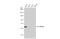 Cytochrome P450 Family 1 Subfamily B Member 1 antibody, GTX104424, GeneTex, Western Blot image 