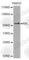 AXL Receptor Tyrosine Kinase antibody, A0532, ABclonal Technology, Western Blot image 
