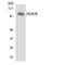 Diacylglycerol Kinase Beta antibody, A07973-1, Boster Biological Technology, Western Blot image 