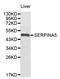 Serpin Family A Member 5 antibody, STJ111056, St John