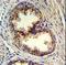 Golgi Phosphoprotein 3 antibody, LS-C100647, Lifespan Biosciences, Immunohistochemistry paraffin image 