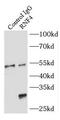 E3 ubiquitin ligase RNF4 antibody, FNab07357, FineTest, Immunoprecipitation image 