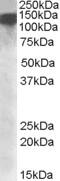 DExH-Box Helicase 9 antibody, MBS422000, MyBioSource, Western Blot image 