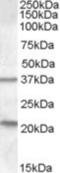 Tumor Suppressor Candidate 3 antibody, NBP1-00248, Novus Biologicals, Western Blot image 