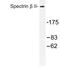 Spectrin Beta, Non-Erythrocytic 2 antibody, LS-C177494, Lifespan Biosciences, Western Blot image 