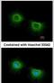 ST3 Beta-Galactoside Alpha-2,3-Sialyltransferase 3 antibody, PA5-31626, Invitrogen Antibodies, Immunofluorescence image 