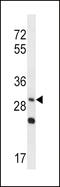 Wnt Family Member 3A antibody, 57-844, ProSci, Western Blot image 
