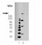 Platelet Derived Growth Factor Receptor Beta antibody, orb89051, Biorbyt, Western Blot image 