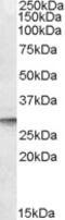 Clathrin Light Chain A antibody, 46-737, ProSci, Enzyme Linked Immunosorbent Assay image 