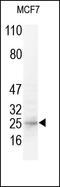 Growth Associated Protein 43 antibody, 251749, Abbiotec, Western Blot image 
