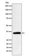 Pyruvate Dehydrogenase E1 Beta Subunit antibody, M03998, Boster Biological Technology, Western Blot image 