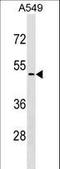 Cyclin Dependent Kinase Like 4 antibody, LS-C159321, Lifespan Biosciences, Western Blot image 