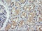 Component Of Oligomeric Golgi Complex 6 antibody, M07158, Boster Biological Technology, Immunohistochemistry paraffin image 