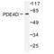 Phosphodiesterase 4D antibody, AP06558PU-N, Origene, Western Blot image 