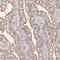 CXADR Ig-Like Cell Adhesion Molecule antibody, NBP1-88194, Novus Biologicals, Immunohistochemistry paraffin image 