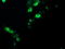 Chaperonin Containing TCP1 Subunit 8 Like 2 antibody, LS-C787545, Lifespan Biosciences, Immunofluorescence image 