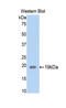 Serpin Family A Member 6 antibody, LS-C298644, Lifespan Biosciences, Western Blot image 