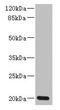 Zinc Finger Matrin-Type 5 antibody, LS-C372052, Lifespan Biosciences, Western Blot image 