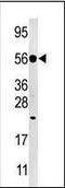 Cholinergic Receptor Muscarinic 3 antibody, orb95515, Biorbyt, Western Blot image 