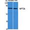 Sodium-dependent phosphate transport protein 2B antibody, LS-C386863, Lifespan Biosciences, Western Blot image 