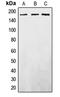 EGFR antibody, LS-C352224, Lifespan Biosciences, Western Blot image 