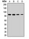 Enhancer Of Zeste 2 Polycomb Repressive Complex 2 Subunit antibody, LS-C668256, Lifespan Biosciences, Western Blot image 