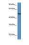 Zinc Finger Protein 275 antibody, NBP1-91319, Novus Biologicals, Western Blot image 