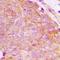Choline Kinase Beta antibody, LS-C368853, Lifespan Biosciences, Immunohistochemistry frozen image 