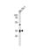 Interleukin 3 Receptor Subunit Alpha antibody, abx034887, Abbexa, Western Blot image 