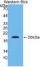 SPT6 Homolog, Histone Chaperone And Transcription Elongation Factor antibody, LS-C315034, Lifespan Biosciences, Western Blot image 