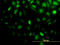 Stress Induced Phosphoprotein 1 antibody, LS-C133666, Lifespan Biosciences, Immunofluorescence image 