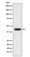 Phosphate Cytidylyltransferase 1, Choline, Alpha antibody, M04091, Boster Biological Technology, Western Blot image 