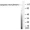 Caspase Recruitment Domain Family Member 6 antibody, PA5-49737, Invitrogen Antibodies, Western Blot image 