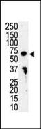 Interleukin 1 Receptor Associated Kinase 3 antibody, PA5-14916, Invitrogen Antibodies, Western Blot image 
