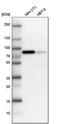 Lipoma-preferred partner antibody, PA5-53590, Invitrogen Antibodies, Western Blot image 