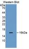 Vascular Endothelial Growth Factor C antibody, LS-C720759, Lifespan Biosciences, Western Blot image 