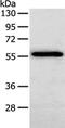 Serpin Family F Member 2 antibody, CSB-PA294574, Cusabio, Western Blot image 