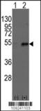 Dystrobrevin Binding Protein 1 antibody, TA300078, Origene, Western Blot image 