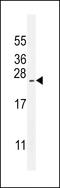 ADP Ribosylation Factor Like GTPase 17B antibody, 55-938, ProSci, Western Blot image 