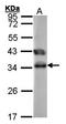 Tetratricopeptide Repeat Domain 1 antibody, orb69727, Biorbyt, Western Blot image 