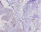 Lysyl Oxidase Like 1 antibody, A52956-100, Epigentek, Immunohistochemistry paraffin image 