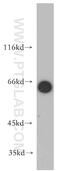 Forkhead Box O4 antibody, 21535-1-AP, Proteintech Group, Western Blot image 