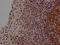 High Mobility Group Box 1 antibody, CSB-RA439052A0HU, Cusabio, Immunohistochemistry paraffin image 
