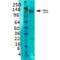 Solute Carrier Family 12 Member 5 antibody, 11564, QED Bioscience, Western Blot image 