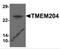 Transmembrane Protein 204 antibody, 6415, ProSci, Western Blot image 