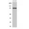 FYN Binding Protein 1 antibody, LS-C383588, Lifespan Biosciences, Western Blot image 